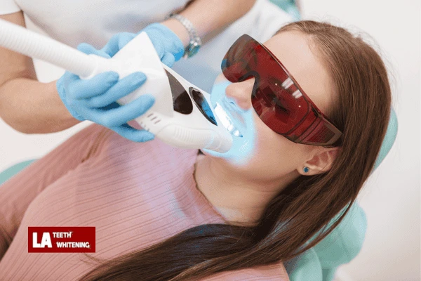 Do You Get Instant Hollywood-White Teeth After One Session Burgess Hill
