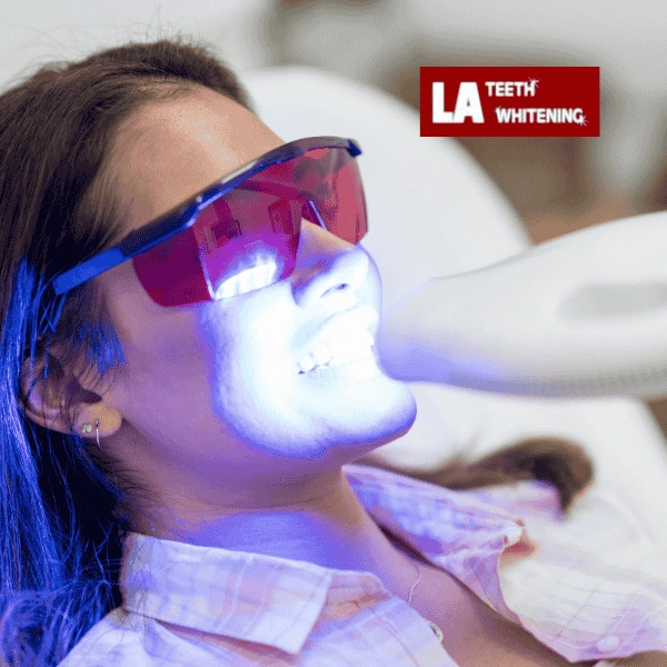 Contact LA Teeth Whitening Today! Book your appointment!Contact LA Teeth Whitening Today! Book your appointment! Burgess Hill
